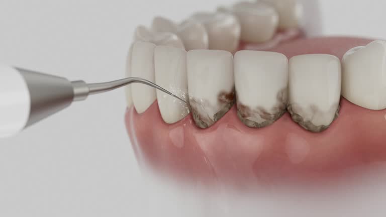 Reliable Teeth Cleaning And Checkup contractor in Sumter County County, AL by Dentist Open Now